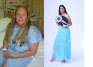 Dr John Jorgensen - Weight Loss Sydney